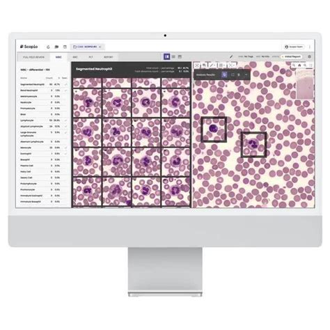 Scopio Full Field Digital Cell Morphology Beckman Coulter