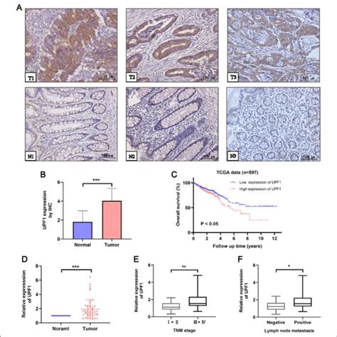 Upf Expression Is Upregulated In Crc Tissues Compared To Adjacent