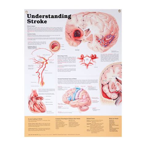 Anatomical Wall Charts Vinyl-Laminated | North Coast Medical