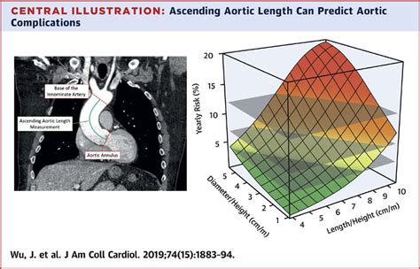 Ascending Aortic Length And Risk Of Aortic Adverse Events The