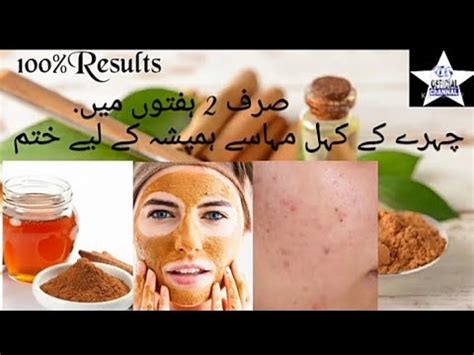 How to remove Acne dark spots چہرے کے داغ دھبے ہمیشہ کے لیےختم Acne