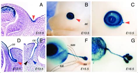 Lacrimal Gland Development A Section Of The Eye In An E P