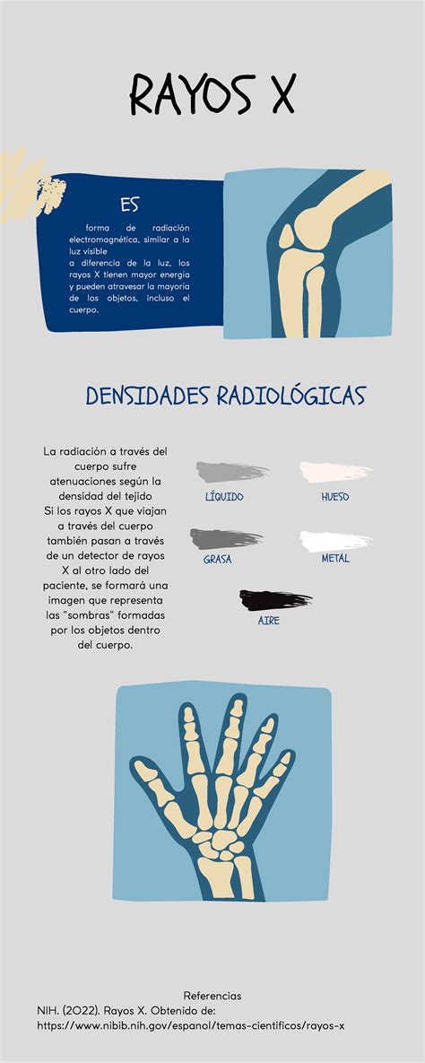 Rayos X Infograf A Metal Rayos X Forma De Radiaci N Electromagn Tica