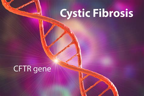 Cystic Fibrosis Etiology Rare Disease Advisor