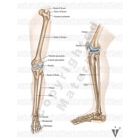 Stock Lower Limb Orthopedic — Illustrated Verdict