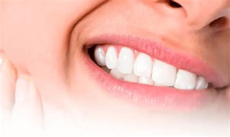 Dentista Em Londrina Rozante Odontologia