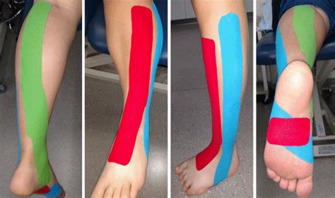 Effects Of The Direction Of Kinesio Taping On Sensation And