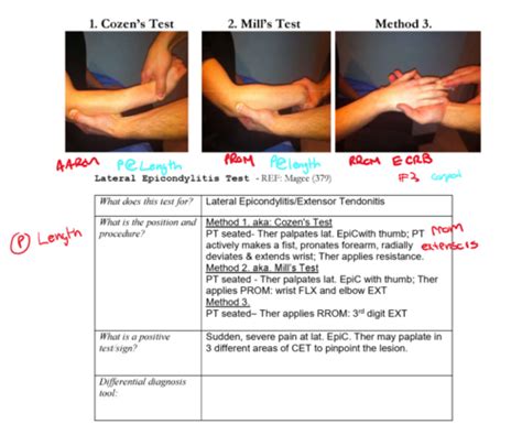Elbow Special Tests Flashcards Quizlet