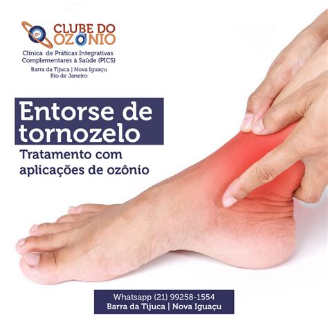 Entorse de tornozelo Tratamento aplicações de ozônio