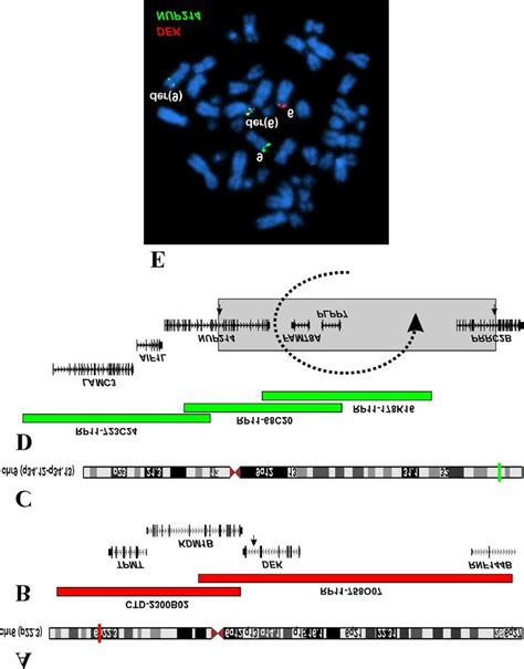 Fluorescence In Situ Hybridization Fish Of Bone Marrow Cells From The