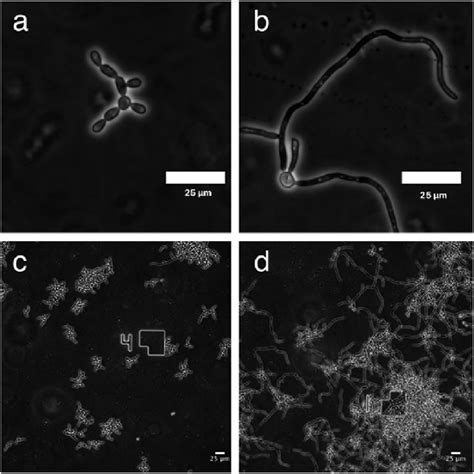 Microscope Images Of C Albicans Show Yeast Like Morphology Upon Gdl