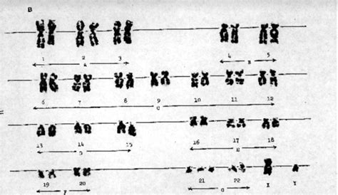 SOLVED: If you look closely at the chromosomes in karyotype B versus ...