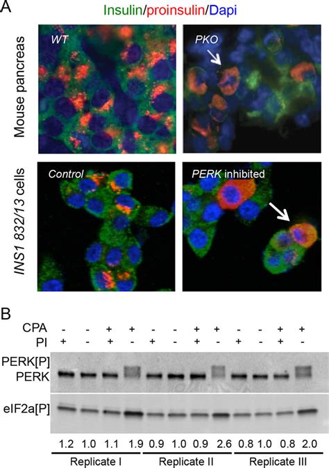 Inhibition Of Perk Activity Recapitulates Cell Dysfunctions Found In