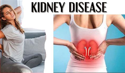 Kidney Disease - Health & Beauty Care