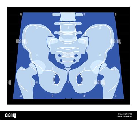 Ct Pelvic Bones Stock Vector Images Alamy