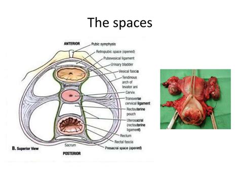 Ppt Pelvic Surgical Anatomy Powerpoint Presentation Free Download