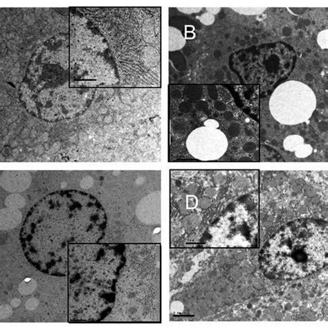 Electron Microscope Examination Of Rat Liver Tissue Tm ×3700 ×8900 Download Scientific