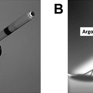 Argon Plasma Coagulation Apc A Argon Plasma Coagulator Probe Erbe