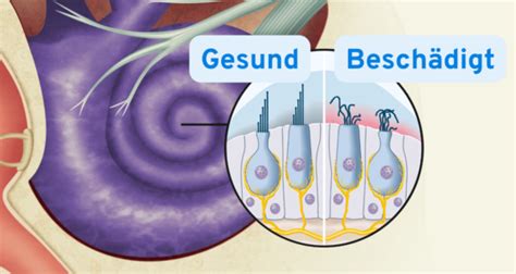 Wie Funktioniert Das Ohr H Rprozess In Stufen Erkl Rt Echo