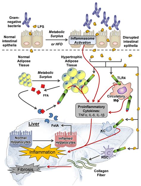 Nutrients Free Full Text Non Alcoholic Steatohepatitis And