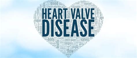 Heart Valve Diseases: Causes, Symptoms and Treatment