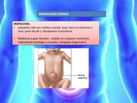 Hernias De La Pared Abdominal Eventracion Y Eviceracion