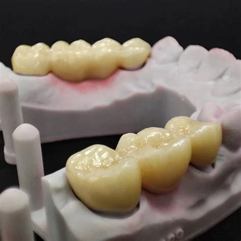 Captek Precious Metal Ceramic Denture Soft Alloy Co Cr Porcelain