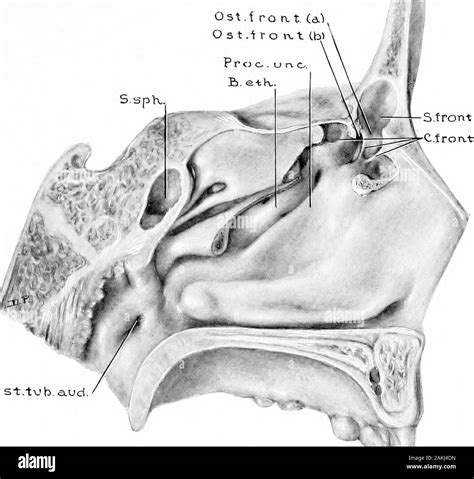 Infundibulum Nose