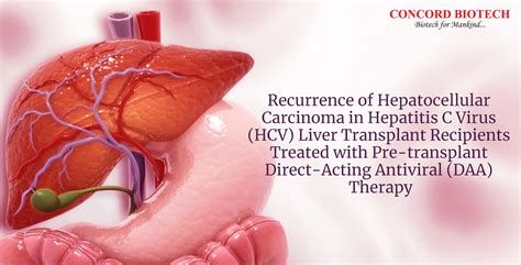 Recurrence Of Hepatocellular Carcinoma In Hcv Liver Transplant Recipients Treated With Direct