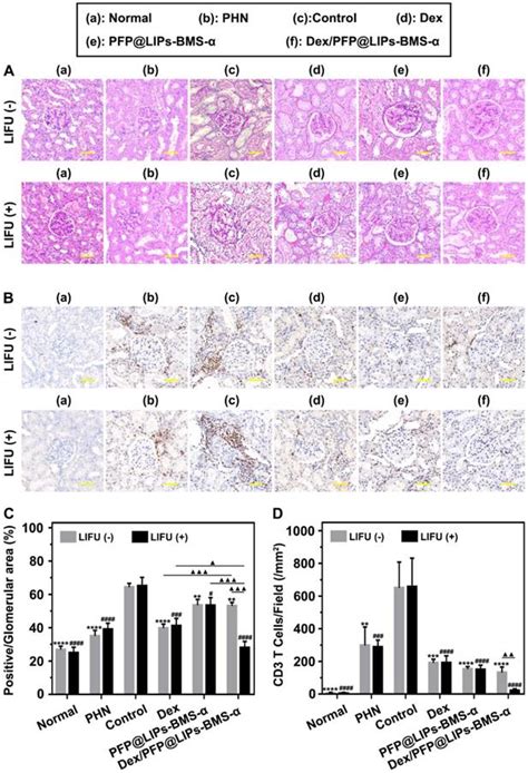 Visualized Podocyte Targeting And Focused Ultrasound Responsive