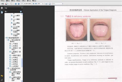 《中医舌诊彩色图谱》扫描版 Pdf 看医学网