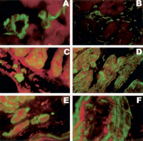 Figure From Transendocardial Autologous Bone Marrow Mononuclear Cell