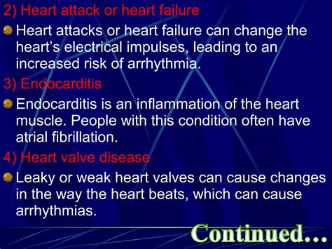 Cardiac arrhythmia | PPT