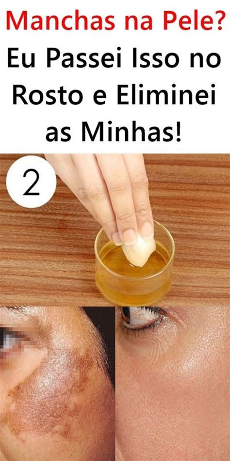 Manchas Na Pele Eu Passei Isso No Rosto E Eliminei As Minhas Facial