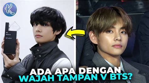 Bts Sebelum Operasi Plastik