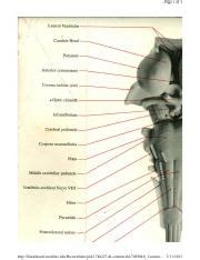 Brainstem Model Anterior View 1 Pdf Page 1 Of 1 Blackboard