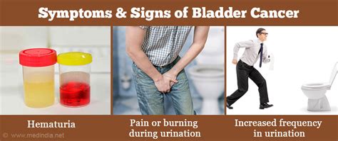 Bladder Cancer – Symptoms, Signs, Diagnosis, Treatment, Prognosis ...