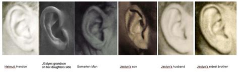 SOMERTON MAN: THE EAR COMPARISON, DETAILED IMAGE. YOU DECIDE ...