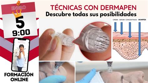 Técnicas con Dermapen Cuándo utilizo el dermapen YouTube