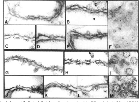 Figure From Structural Analysis Of The P Complex An Assembly Of O