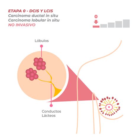 Estad Os Del C Ncer De Mama Festival De La Mujer