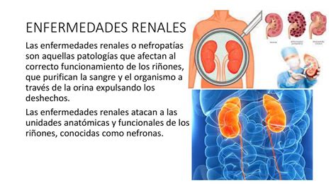 Enfermedades Renales Enoc UDocz