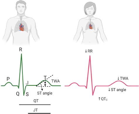 Sex Differences In Electrocardiogram Ecg Interval Between Two Download Scientific Diagram