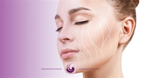 Fios De Sustenta O Elimine A Flacidez Facial Harmoniza O Facial Em