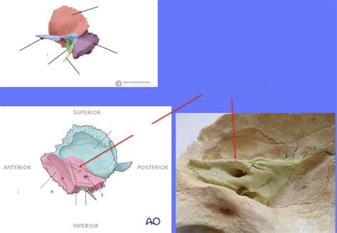 Temporal Bone Portions Diagram Quizlet