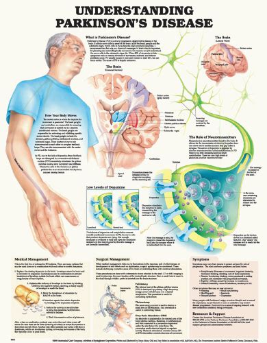 Parkinsons Disease Nurse Key