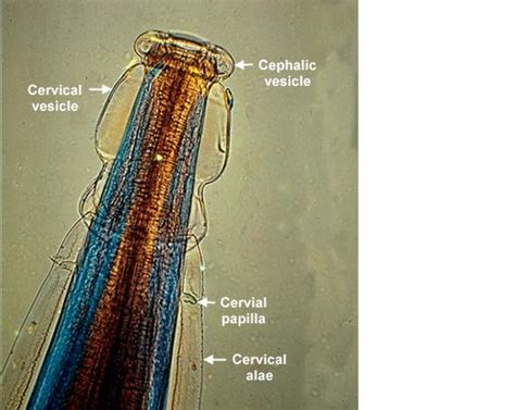 Oesophagostomum Pathophysiology Wikidoc