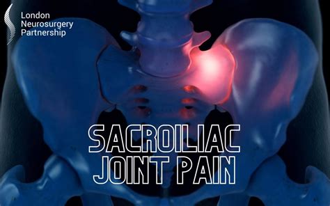 Sacroiliac joint pain - London Neurosurgery Partnership - Spine ...