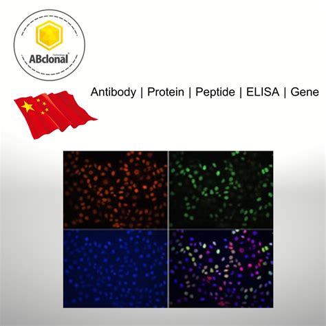 Antibodies, ABclonal, China - BioEntist Co., Ltd.