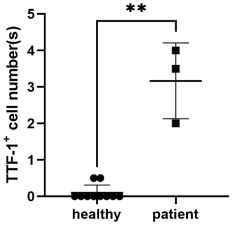 Ijms Special Issue Circulating Tumor Cells Liquid Biopsies And